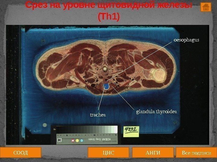 Срез на уровне щитовидной железы (Th 1) oesophagus trachea glandula thyroidea СООД ЦНС АНГИ