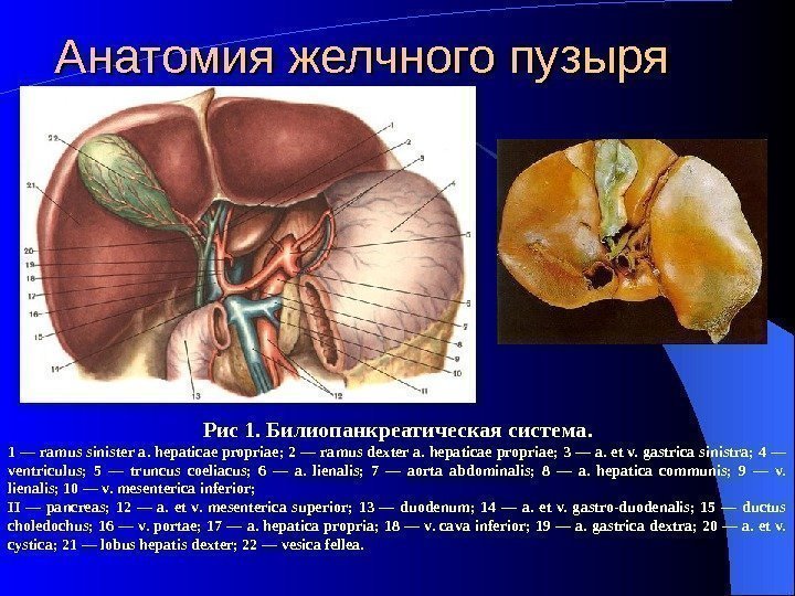 Анатомия желчного пузыря Рис 1.  Билиопанкреатическая система. 1 — ramus sinister a. hepaticae