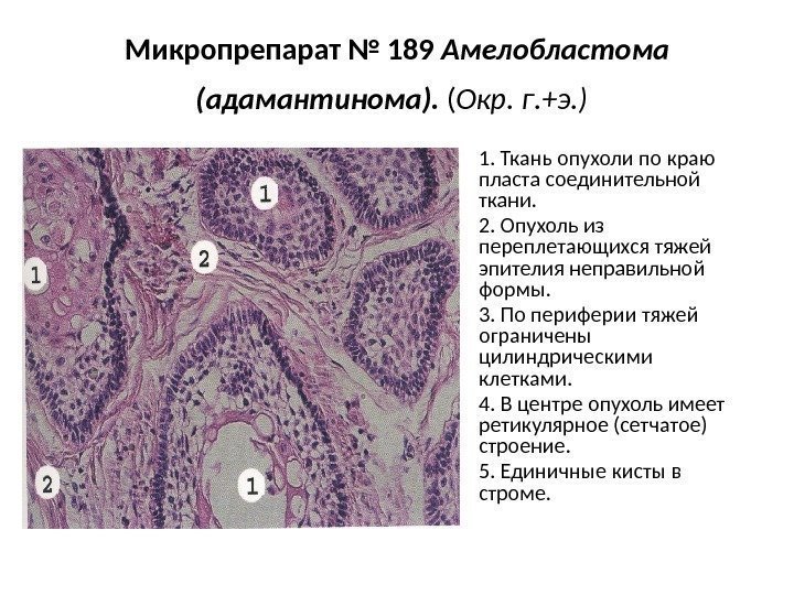 Фиброз печени фото