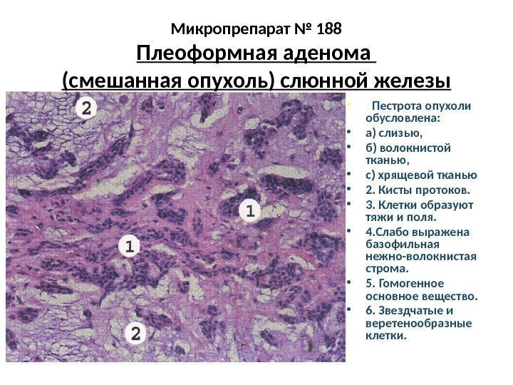 Опухоль слюнной железы фото