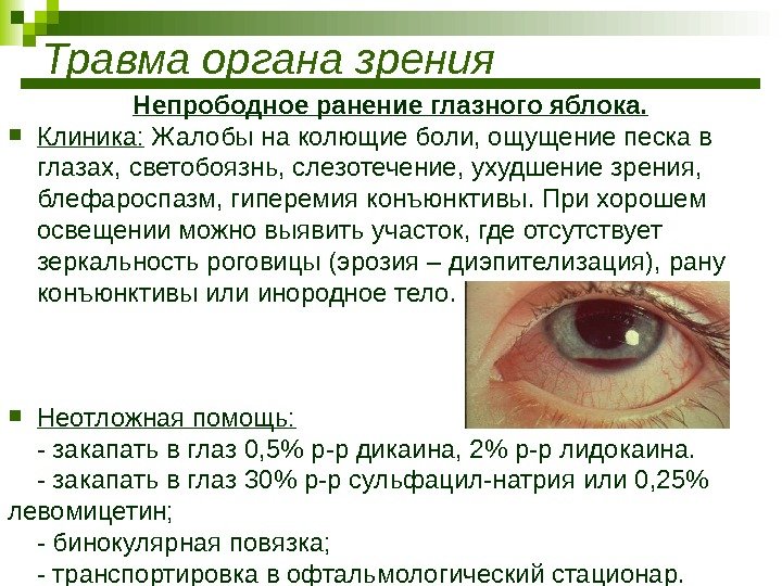 Травма органа зрения Непрободное ранение глазного яблока.  Клиника:  Жалобы на колющие боли,