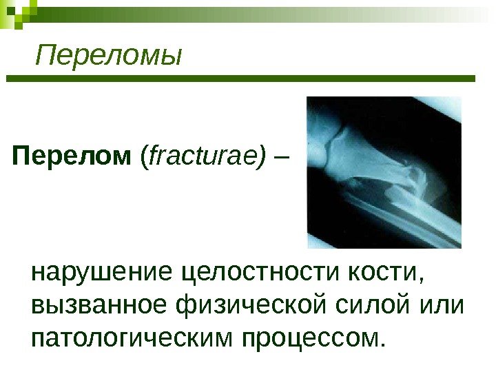 Переломы Перелом ( fracturae) – нарушение целостности кости,  вызванное физической силой или патологическим