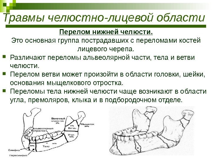 Травмы челюстно-лицевой области Перелом нижней челюсти. Это основная группа пострадавших с переломами костей лицевого