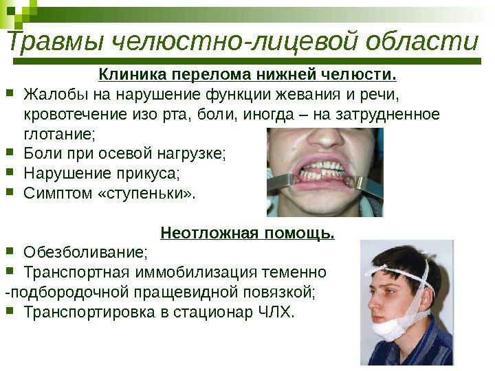Травмы челюстно-лицевой области Клиника перелома нижней челюсти.  Жалобы на нарушение функции жевания и