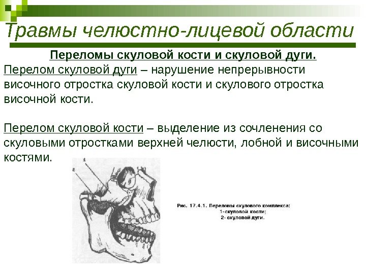Травмы челюстно-лицевой области Переломы скуловой кости и скуловой дуги. Перелом скуловой дуги – нарушение