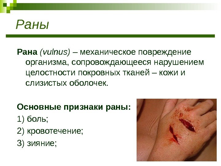 Раны Рана (vulnus) – механическое повреждение организма, сопровождающееся нарушением целостности покровных тканей – кожи