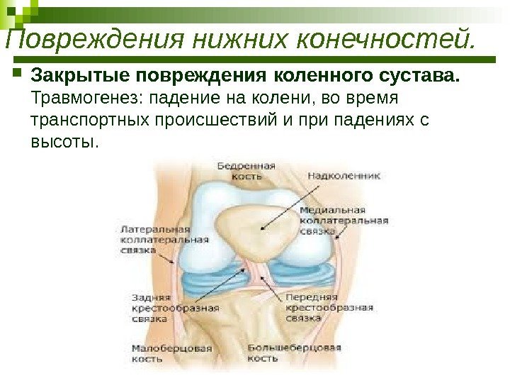  Закрытые повреждения коленного сустава.  Травмогенез: падение на колени, во время транспортных происшествий