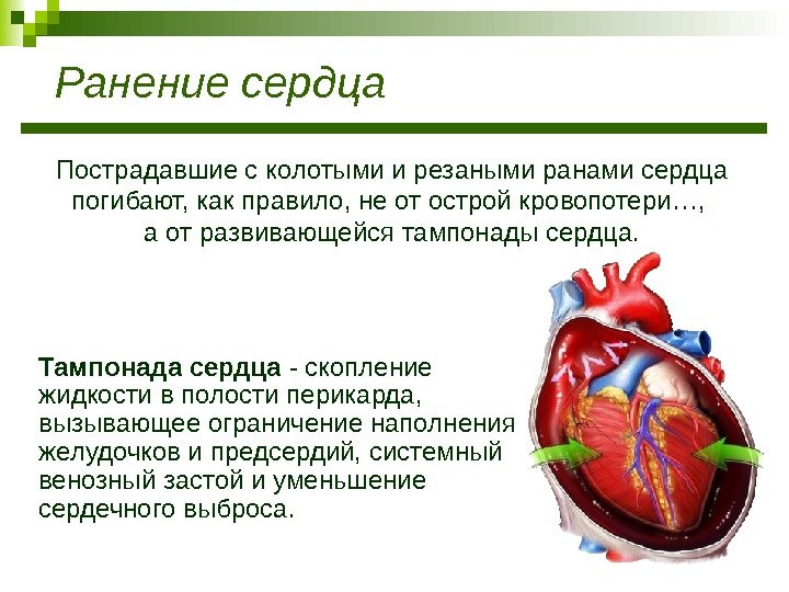 Ранение сердца Пострадавшие с колотыми и резаными ранами сердца погибают, как правило, не от