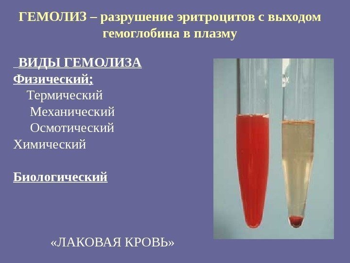 ГЕМОЛИЗ – разрушение эритроцитов с выходом гемоглобина в плазму  ВИДЫ ГЕМОЛИЗА Физический; 