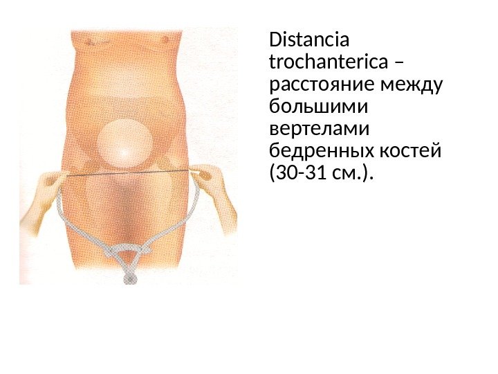 Distancia trochanterica – расстояние между большими вертелами бедренных костей (30 -31 см. ). 