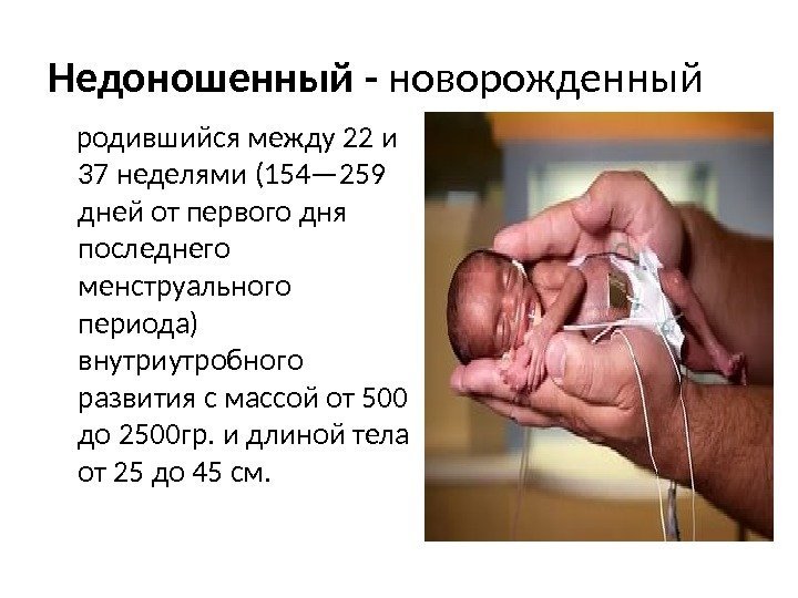 Недоношенный - новорожденный родившийся между 22 и 37 неделями (154— 259 дней от первого