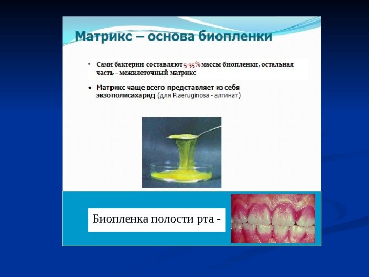 Биопленка полости рта - 