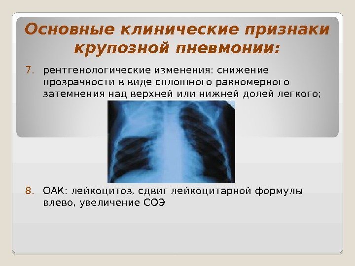 Основные клинические признаки крупозной пневмонии: 7. рентгенологические изменения: снижение прозрачности в виде сплошного равномерного