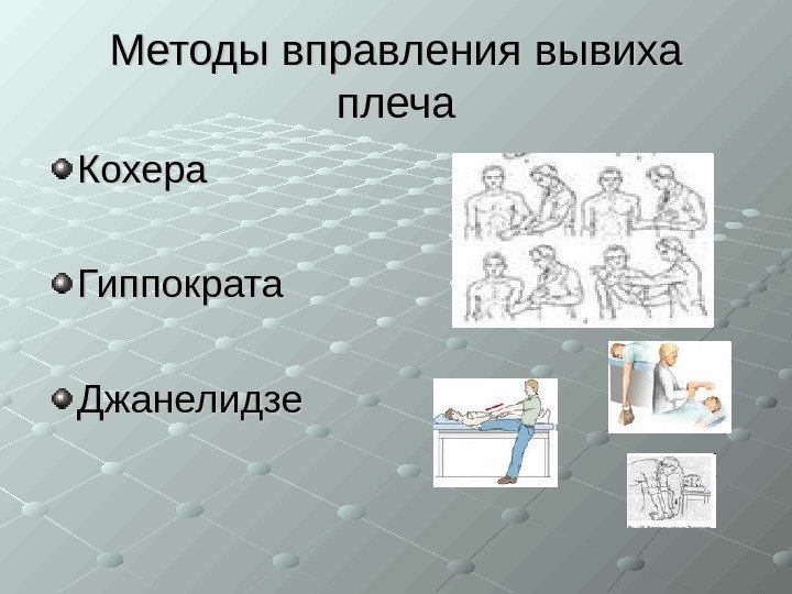   Методы вправления вывиха плеча Кохера Гиппократа Джанелидзе 