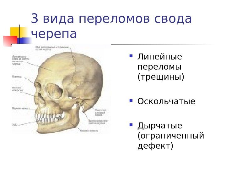   3 вида переломов свода черепа Линейные переломы (трещины) Оскольчатые Дырчатые (ограниченный дефект)