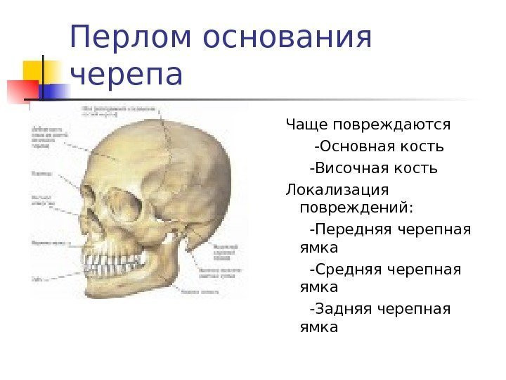   Перлом основания черепа Чаще повреждаются   -Основная кость  -Височная кость