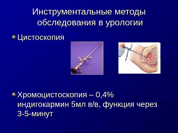   Инструментальные методы обследования в урологии Цистоскопия Хромоцистоскопия – 0, 4 индигокармин 5