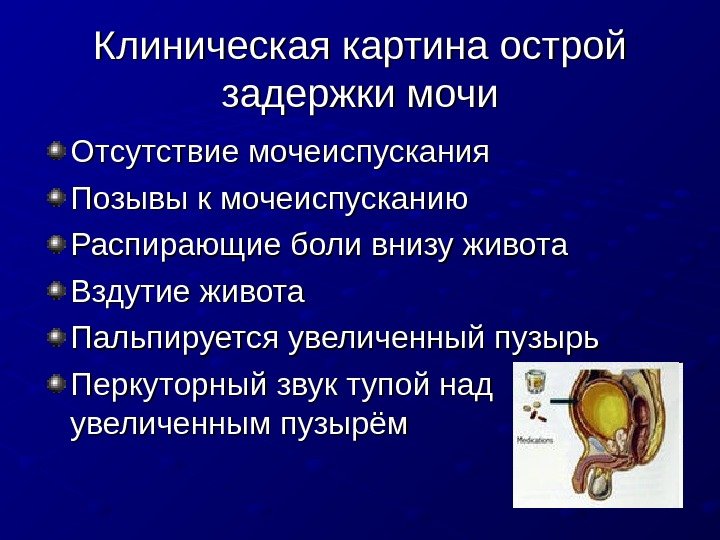   Клиническая картина острой задержки мочи Отсутствие мочеиспускания Позывы к мочеиспусканию Распирающие боли