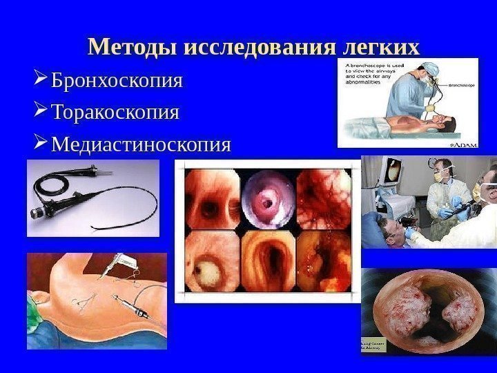 Методы исследования легких Бронхоскопия Торакоскопия Медиастиноскопия 