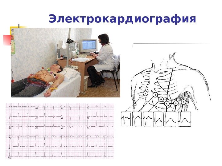 Электрокардиография 