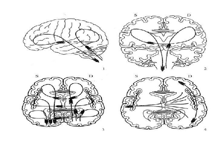 Рисунок стола нейропсихология интерпретация