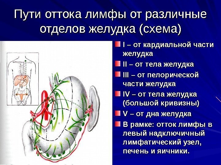 Пути оттока лимфы от различные отделов желудка (схема) II – от кардиальной части желудка