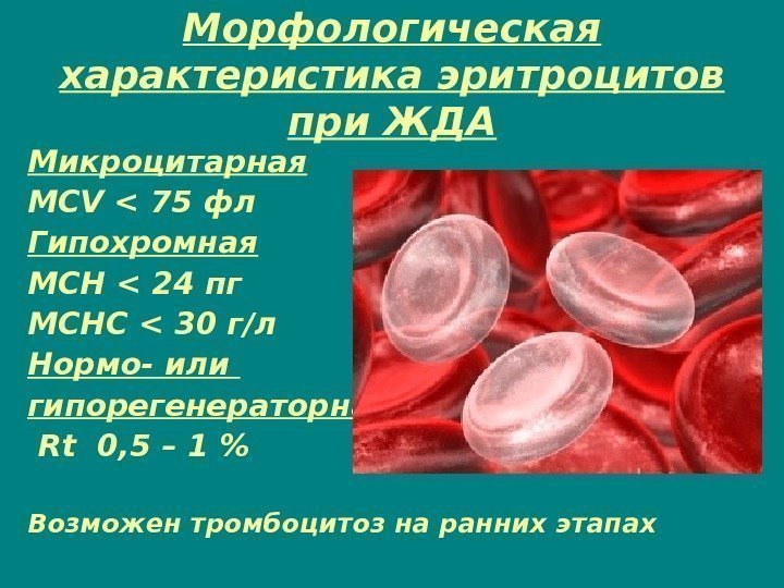 Mch анемия. Диаметр эритроцитов при железодефицитной анемии. Железодефицитная анемия характеристика эритроцитов. Гипохромная анемия MCV. Железодефицитная анемия MCV MCH.