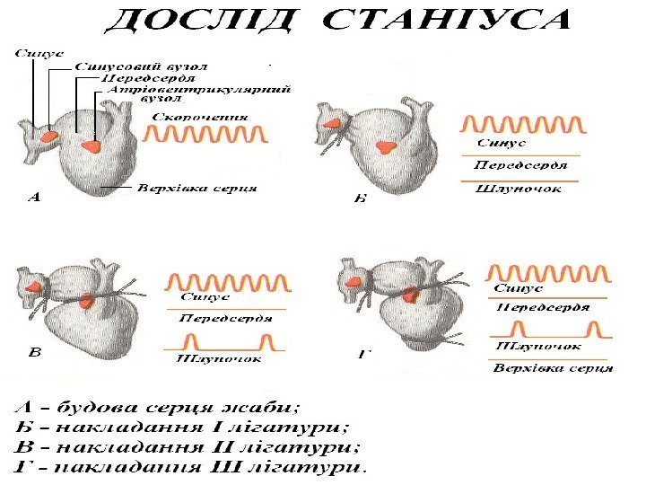 Схема наложения лигатур по станниусу