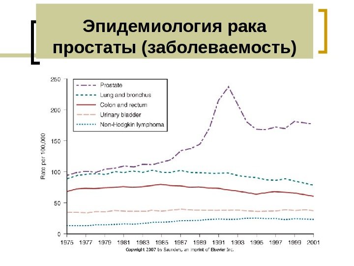 Эпидемиология рака простаты (заболеваемость) 