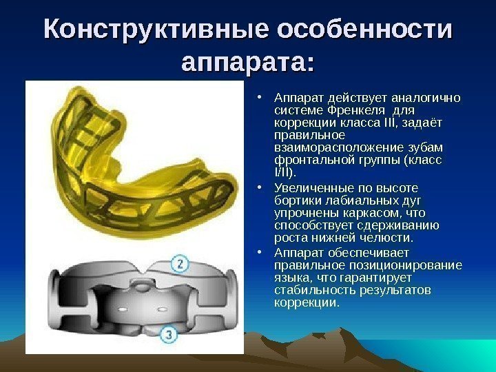 Конструктивные особенности аппарата:  • Аппарат действует аналогично системе Френкеля для коррекции класса III,