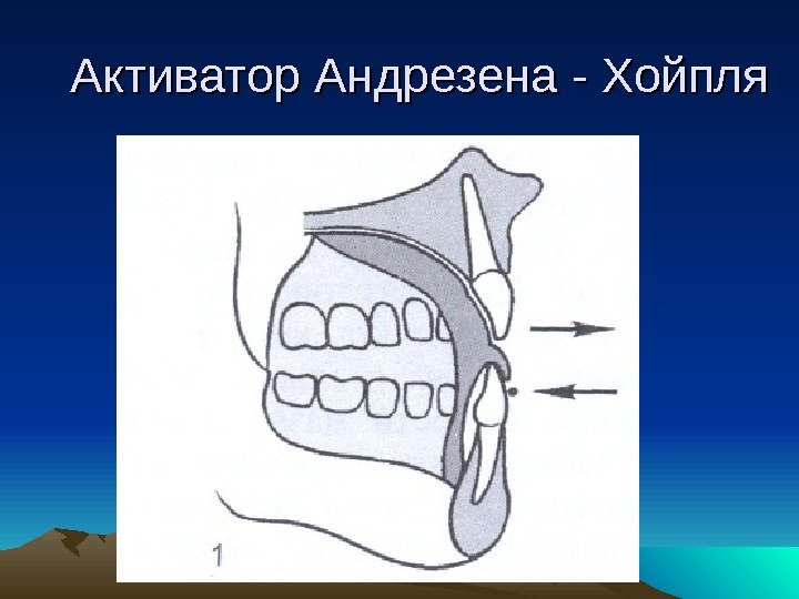 Активатор Андрезена - Хойпля 