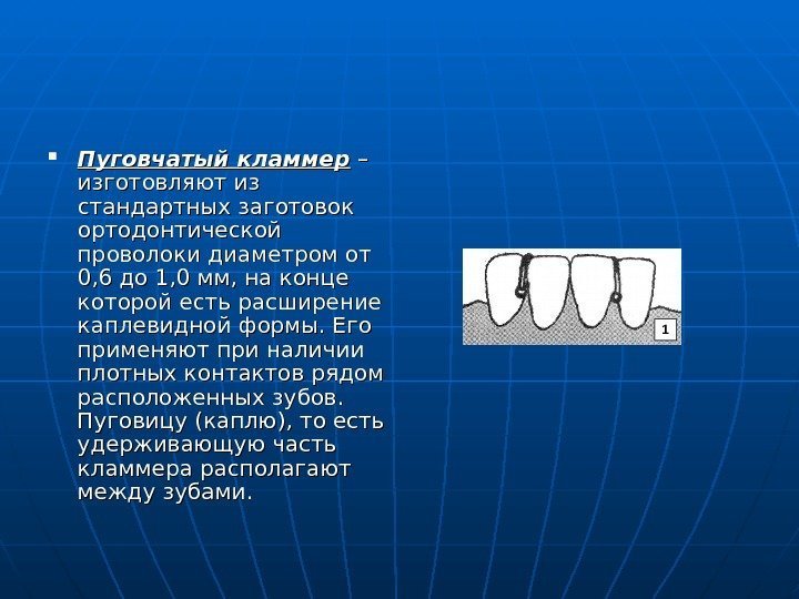   Пуговчатый кламмер – – изготовляют из стандартных заготовок ортодонтической проволоки диаметром от