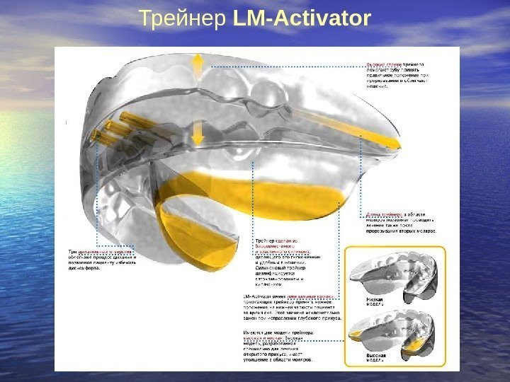   Трейнер LM-Activator 