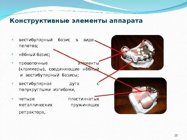 13 Конструктивные элементы аппарата • вестибулярный базис в виде  пелотов;  • нёбный