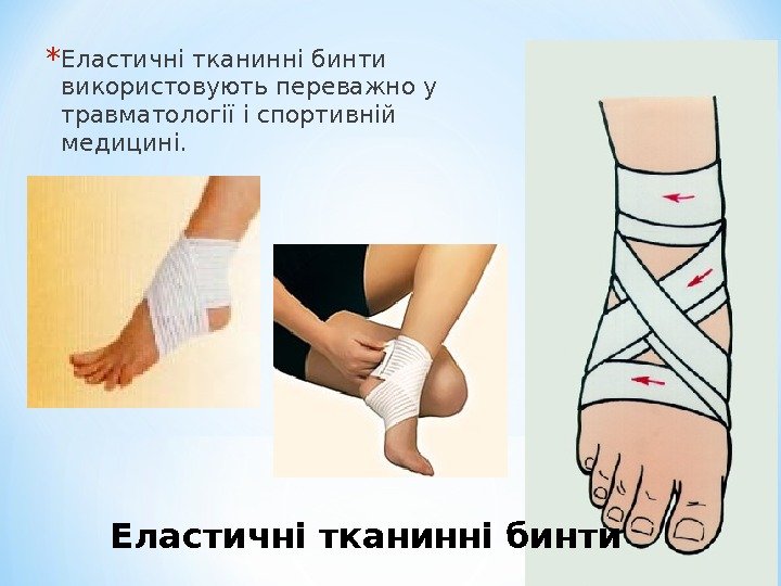 * Еластичні тканинні бинти використовують переважно у травматології і спортивній медицині. Еластичні тканинні бинти
