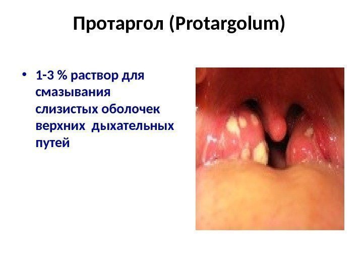 Протаргол ( Protargolum )  • 1 -3  раствор для смазывания слизистых оболочек