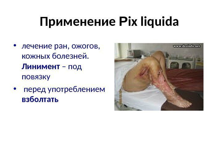 Применение  Р ix liquida  • лечение ран, ожогов,  кожных болезней. Линимент