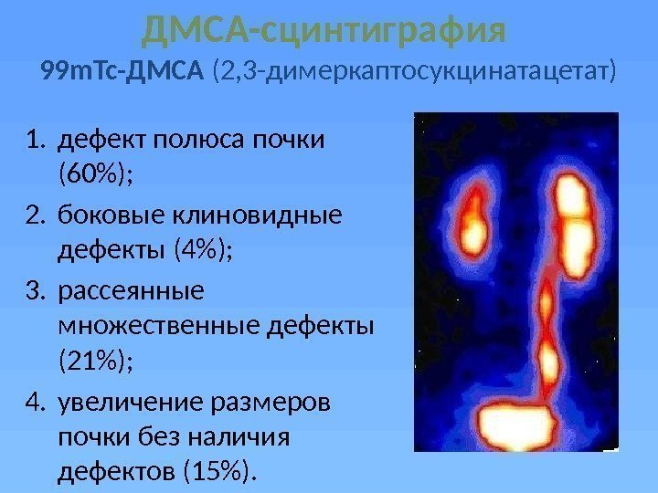 История болезни нефрит