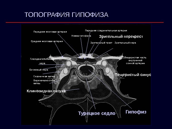 Ножка гипофиза Передняя соединительная артерия Зрительный тракт Зрительный перекрест Пещеристая часть внутренней сонной артерии