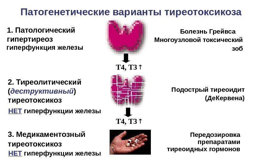 Патогенетические варианты тиреотоксикоза 1. Патологический гипертиреоз 2. Тиреолитический ( деструктивный ) тиреотоксикоз 3. Медикаментозный