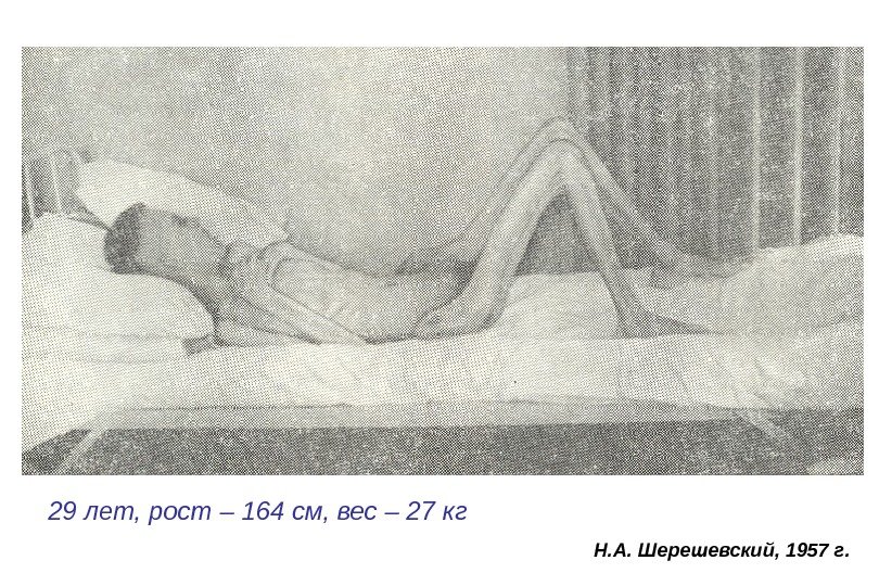 29 лет, рост – 164 см, вес – 27 кг Н. А. Шерешевский, 1957