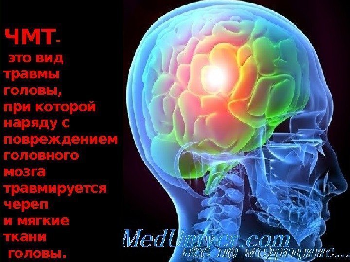 ЧМТ - это вид травмы головы,  при которой наряду с повреждением головного мозга
