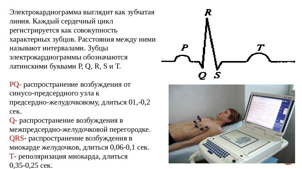 Рисунок экг физиология