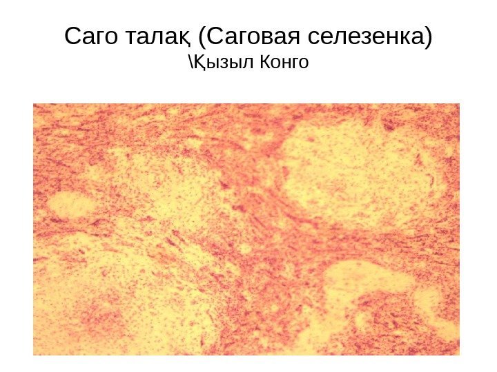   Саго тала (қ Саговая селезенка) \ ызыл Қ Конго 