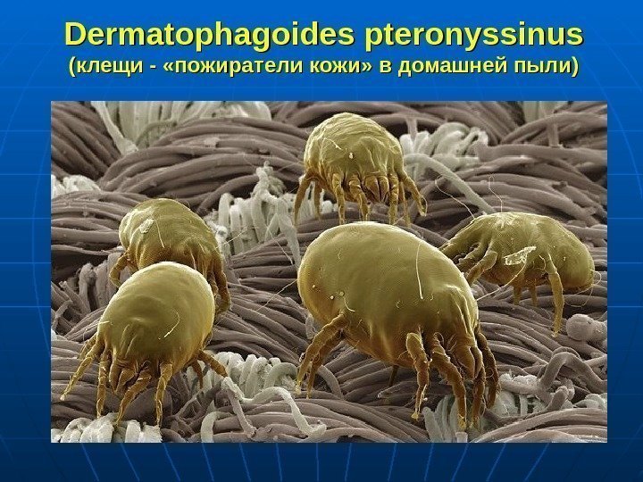 Dermatophagoides pteronyssinus (клещи - «пожиратели кожи» в домашней пыли) 