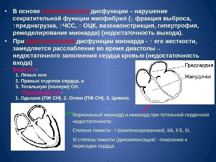  • В основе систолической дисфункции – нарушение сократительной функции миофибрил (↓ фракция выброса,