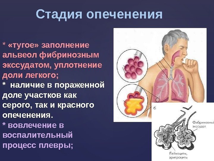 Пневмонии пропедевтика внутренних болезней презентация