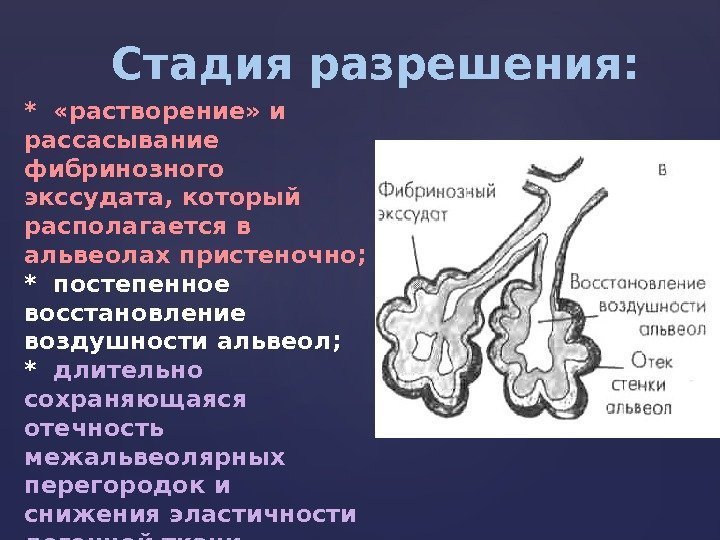 Стадия разрешения