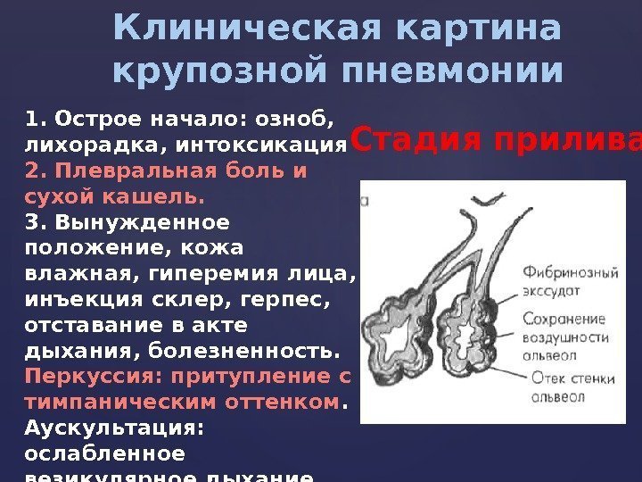 Наиболее возможная аускультативная картина легких при очаговой пневмонии