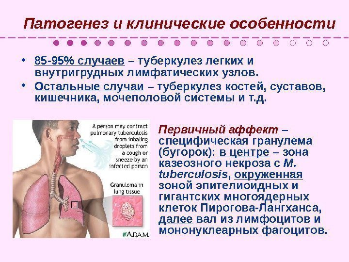   Патогенез и клинические особенности • 85 -95 случаев – туберкулез легких и